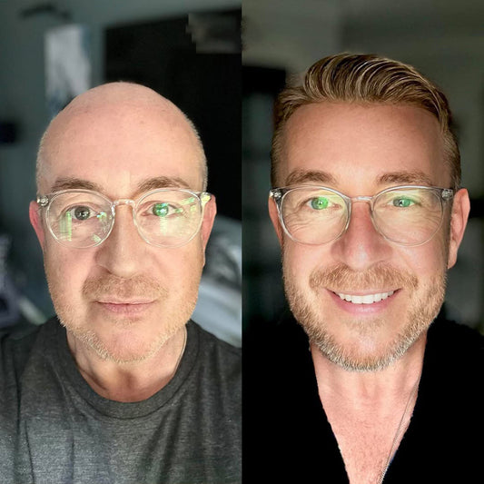Which Hair System Base Should You Choose?