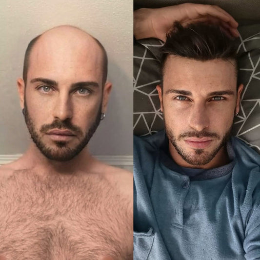 Men's Wig  Swiss Lace Top and Front Thin Leather Sides and Back+Free portable wig stand