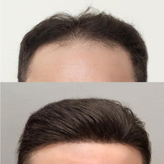 Pieza de línea capilar ultrafina, se adapta al cuero cabelludo y aumenta el grosor del cabello. 